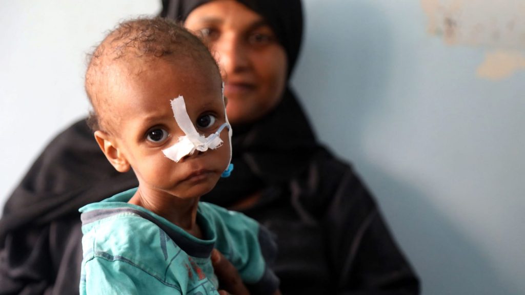اليونيسيف:-10-آلاف-طفل-تعرضوا-للقتل-أو-التشويه-خلال-النزاع-في-اليمن
