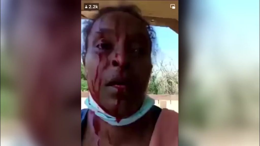 بالفيديو.-امرأة-سودانية-تشتكي-تعرضها-للضرب-على-يد-الجيش