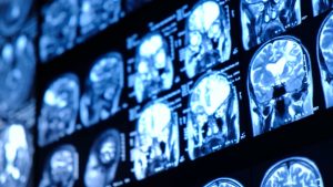 كيف-يمكن-للتكنولوجيا-الكامنة-وراء-chatgpt-أن-تجعل-قراءة-الأفكار-أمرًا-واقعًا؟